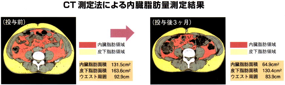 CT測定法による内臓脂肪量測定結果